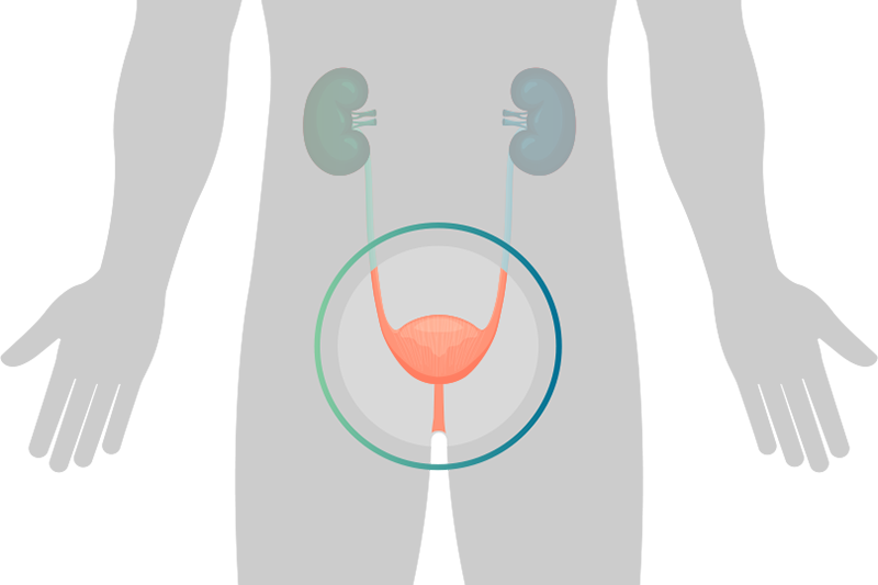 Urology & Incontinence Products